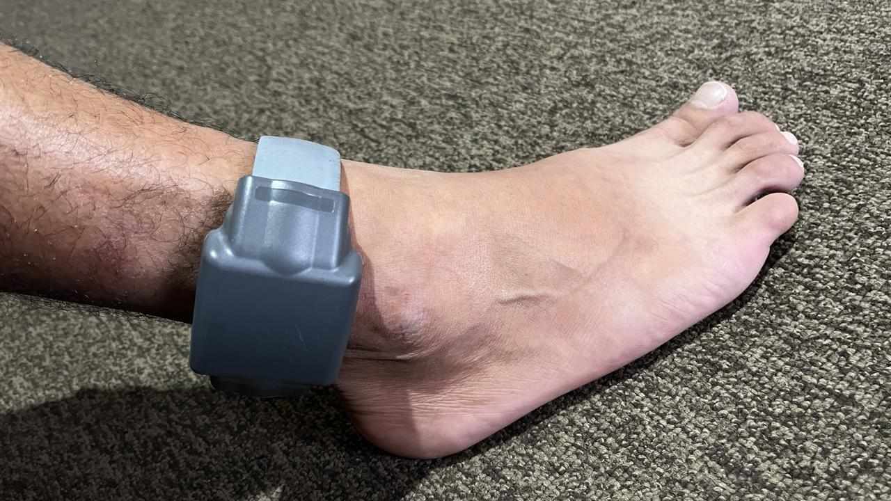 An electronic monitoring ankle bracelet.